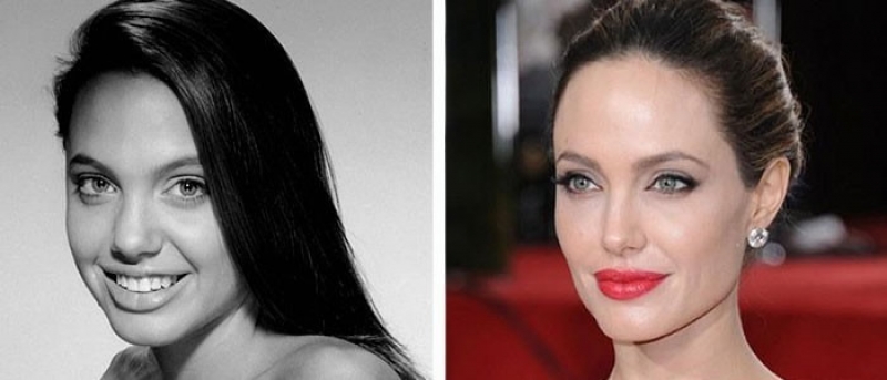 La Rinoplastia de Angelina Jolie